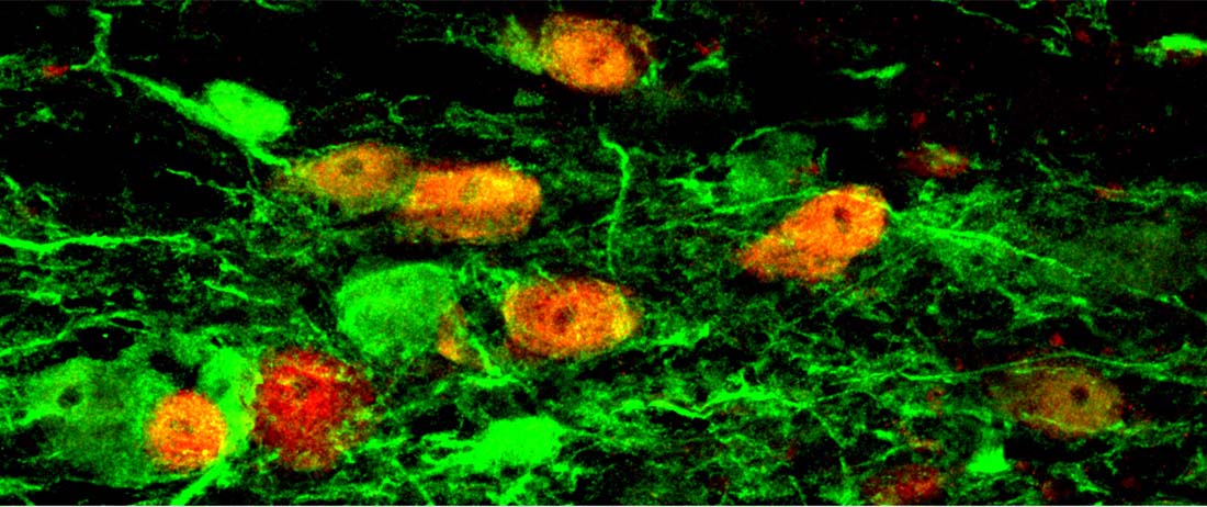 Using strict lineage tracing, UT&nbsp;Southwestern researchers showed that glial cells could be <em>in vivo</em> converted into functional mouse neurons (red). Image is from a previous study by the Chun-Li Zhang laboratory at UT&nbsp;Southwestern.